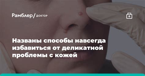 Как избавиться от покрова деликатной плоти щуки