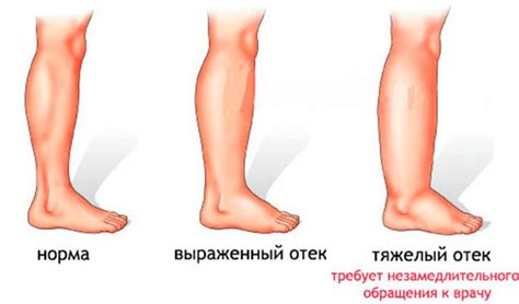 Как облегчить нагрузку на руки при труде на ступенях