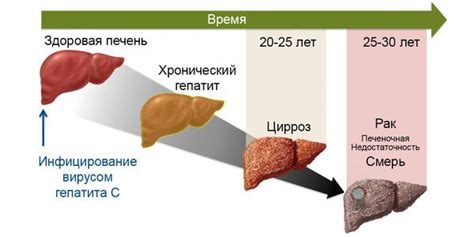 Как передается гепатит В?