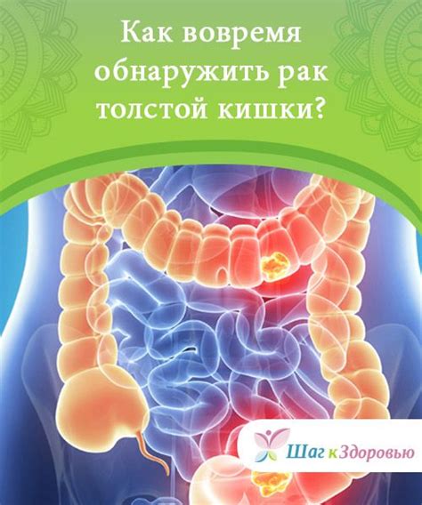 Как подготовиться к исследованию толстой кишки в Самаре: несколько простых рекомендаций