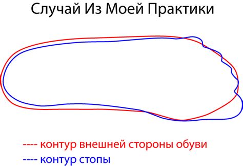 Как правильно выбирать и соответствующим образом фитить обувь, чтобы избежать проблем с пережатыми и малыми размерами