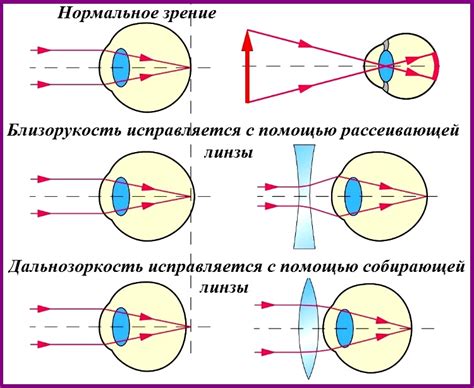 Как работает оптическая коррекция и зачем нужны очки со сниженной силой: