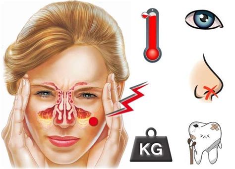 Как распознать проблему: симптомы наличия кисты в полостях носа