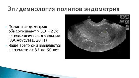 Комплексное лечение гиподенсивного образования в матке