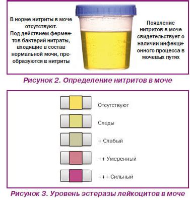 Комплексный подход к восстановлению здоровья при изменении цвета мочи у мужчин