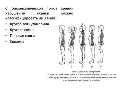 Коррекция осанки и позы тела