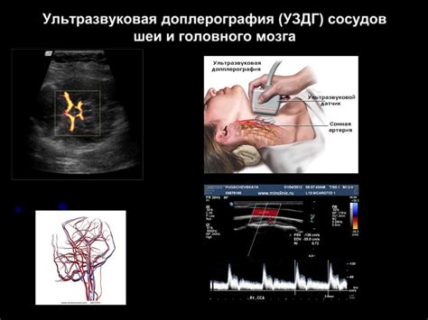 Критерии оценки качества процедуры УЗДГ сосудов шеи