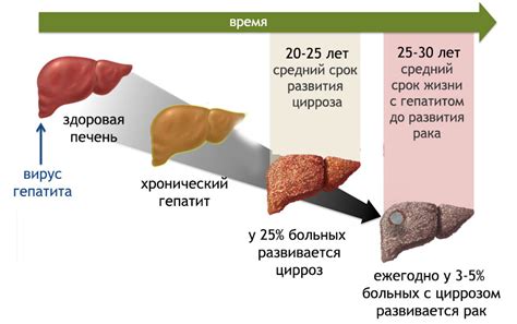 Лечение гепатита с синдромом холестаза