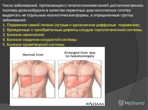 Лечение гепатомегалии почек