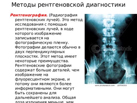 Локации разъемов для рентгеновской диагностики: основные места в медицинских учреждениях