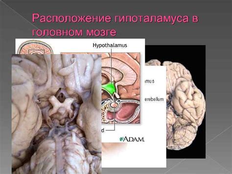 Местоположение гипоталамуса в головном мозге