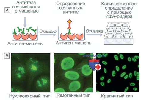 Методы измерения уровня антител, связанных с ядерными структурами