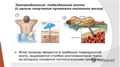 Методы исследования расположения костного мозга в спинном столбе