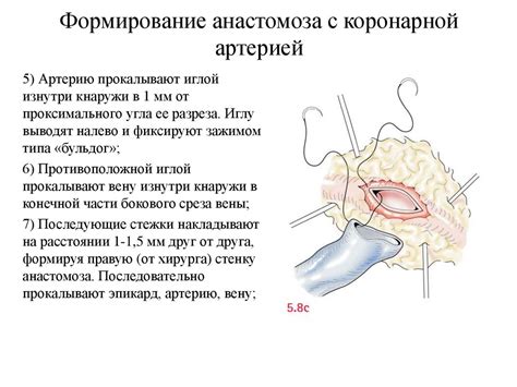 Методы лечения гиподенсного очага