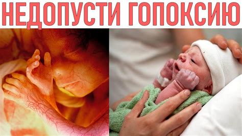 Методы медицинского вмешательства и помощи при состоянии нехватки кислорода у плода во время родов