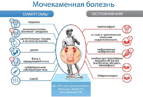 Мочекаменная болезнь: ее сущность и возникновение