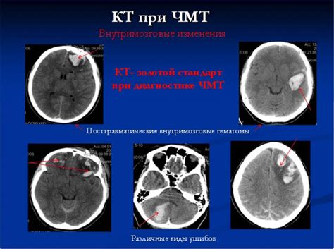 Обзор медицинских учреждений в Самаре для проведения КТ исследования головного мозга