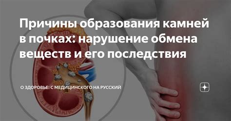 Образование камней в почках и его причины