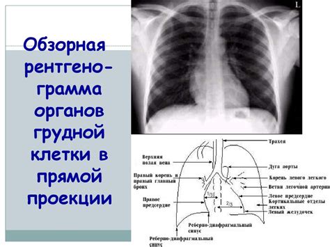 Ограничения при назначении растирки грудной области при лечении пневмонии