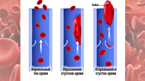 Опасные инфекции, передаваемые мухами: угроза для здоровья человека