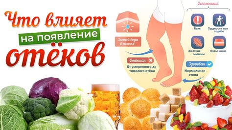 Опасные продукты при отеках ног: что не стоит включать в рацион