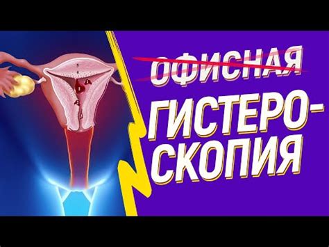 Определение и необходимость гистероскопии