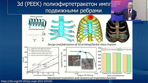 Оптимальное время для ранней коррекции дефектов грудной кости