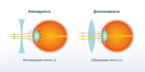 Основные компоненты Дефислез и их воздействие на зрение и оптические линзы