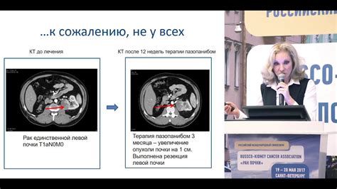 Основные методы лечения гипотензивных очагов