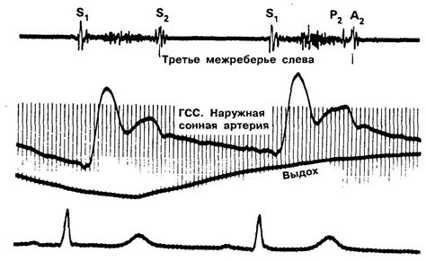 Основные методы обнаружения и оценки верхушечного пульса