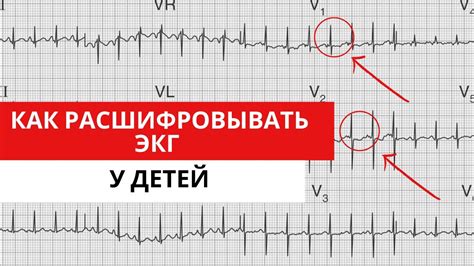 Основные показатели и характеристики ЭКГ у маленьких пациентов: обзор с особым акцентом