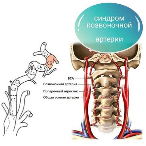 Основные принципы поиска собственной звонкой позвоночной шейки