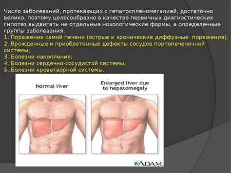 Основные причины гепатоспленомегалии у детей