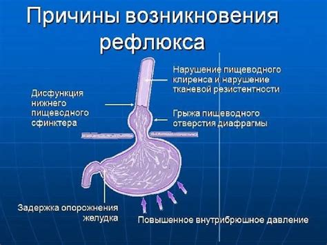 Основные причины гипотонуса кардиального жома