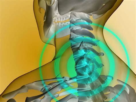 Основные трудности с позвонками в шейном отделе: причины и симптомы