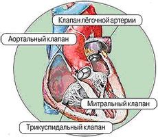 Основные факторы, вызывающие плотность створок аортальных клапанов