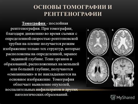 Основы работы рентгеновской томографии позвоночника