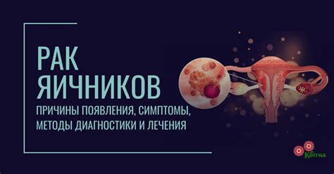 Особенности диагностики поликистоза яичников: методы обнаружения заболевания