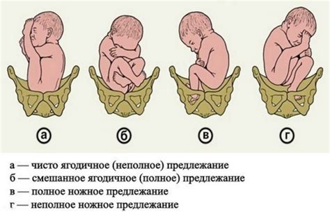 Особенности родов при первой степени недостаточности крови: рекомендации медицинских специалистов