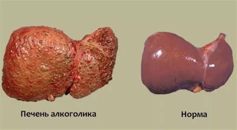 Отрицательное воздействие на печень и почки