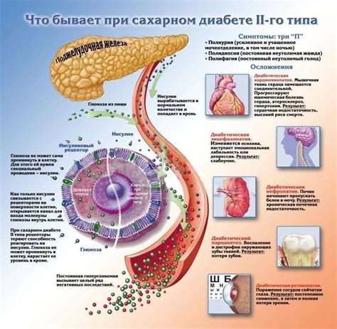 Патогенез второго типа сахарного диабета: почему возникает это заболевание?