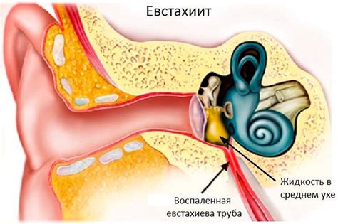 Патологии и нарушения функционирования звуководящей трубы у человека