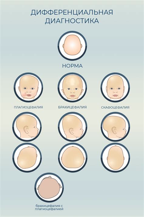 Периодическое удержание головы у малышей