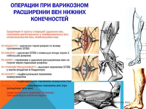 Период восстановления после операции на сосудах нижних конечностей