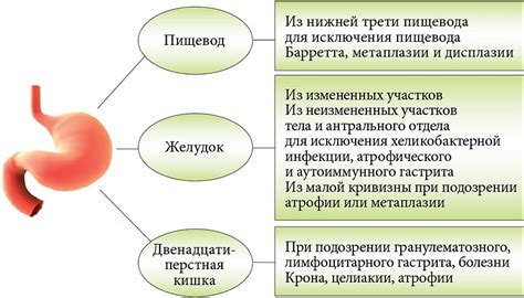 Повреждение слизистой оболочки желудка или пищевода