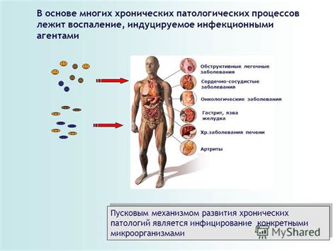 Повышенная вероятность развития хронических патологий