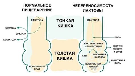 Польза и возможные проблемы с диетой для подростков, страдающих от непереносимости лактозы