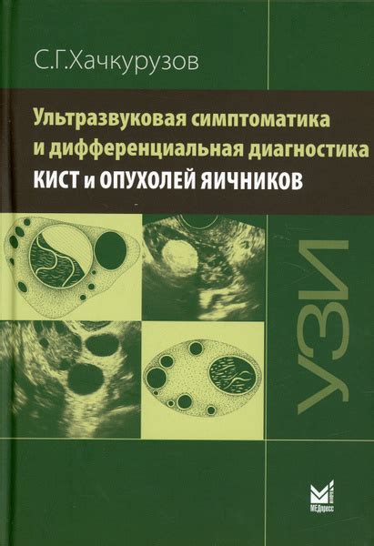 Польза метода компрессионной терапии при наличии кист в области яичников: истинные данные или миф?