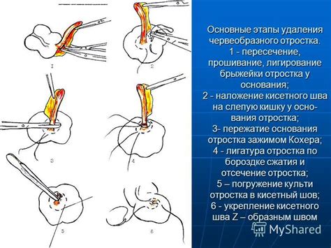 Посадка отростка: основные этапы и необходимые материалы