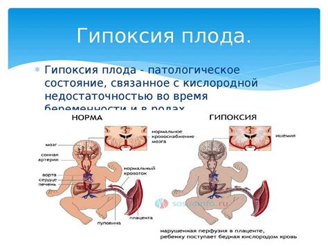 Последствия гипоксии плода при родах